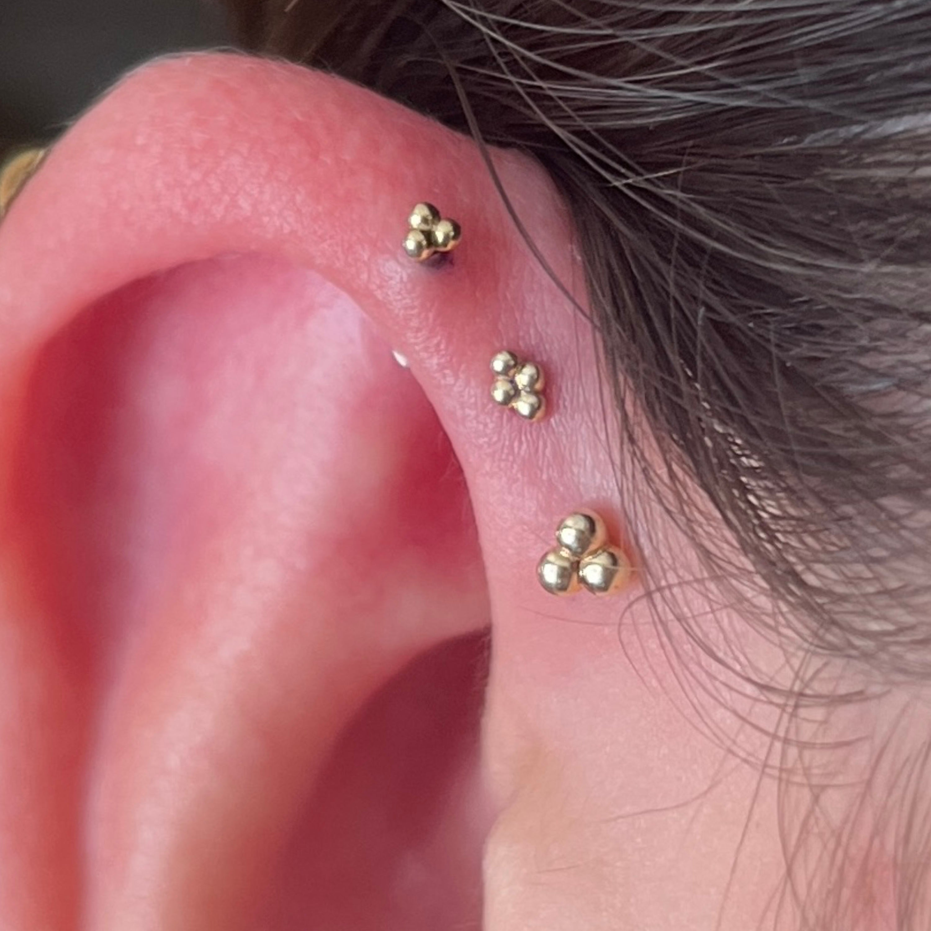 4 Bead